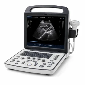 Ultrasound Machine